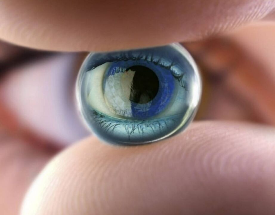 Orthokeratology night lenses will stop the progression of vision impairment
